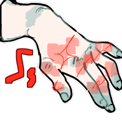 A light greyscale hand with the knuckles highlighted in red, and red pain lines radiating from them.